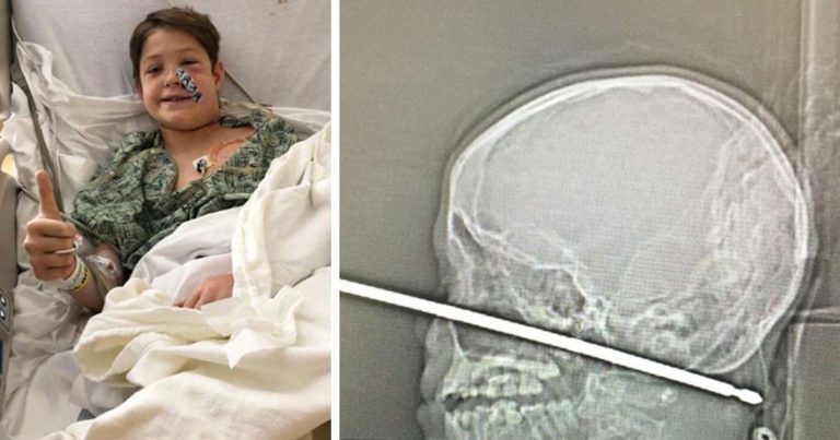 boy impaled by skewer Xavier Cunningham