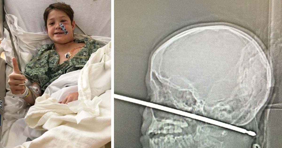 boy impaled by skewer Xavier Cunningham