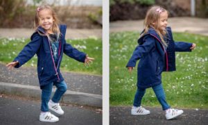 Girl With Backward Legs Walks For The First Time