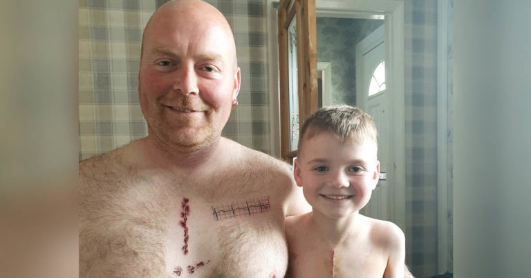 dads-scar-tattoo