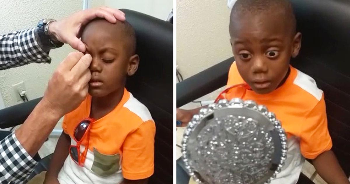 boy-gets-Prosthetic-Eye
