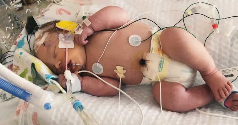 baby dead for 20 minutes Urias John