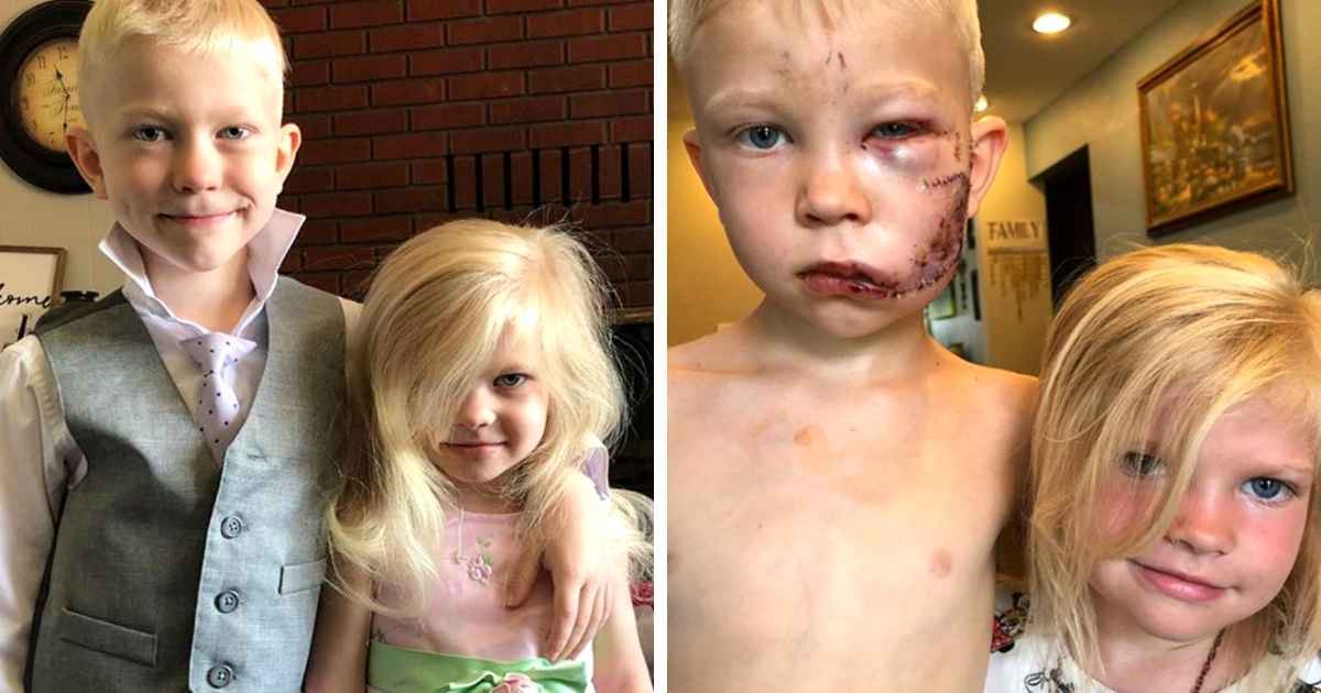 boy-saves-sister-from-dog-attack-bridger-walker