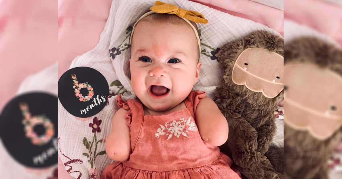 baby-born-without-hands-ivy-jane