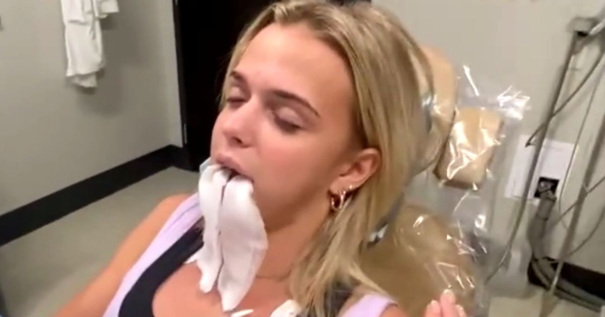 national anthem after wisdom teeth surgery
