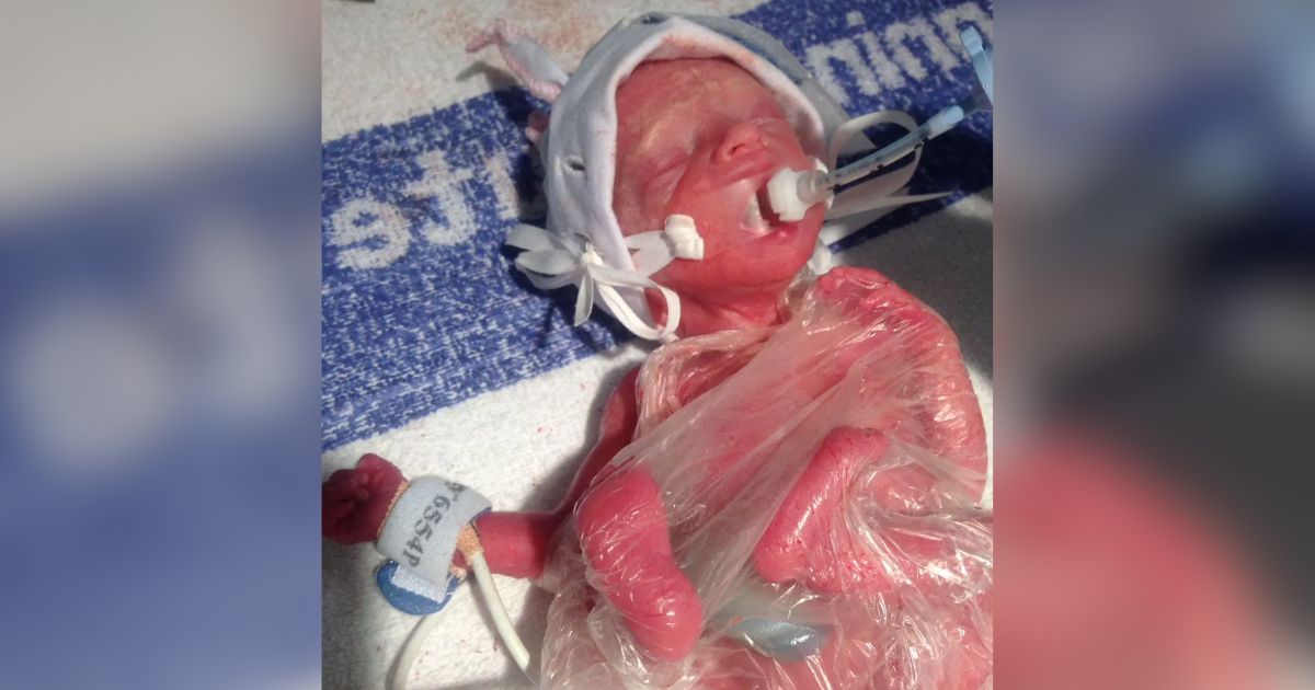 newborn wrapped in sandwich bag darcey glegg