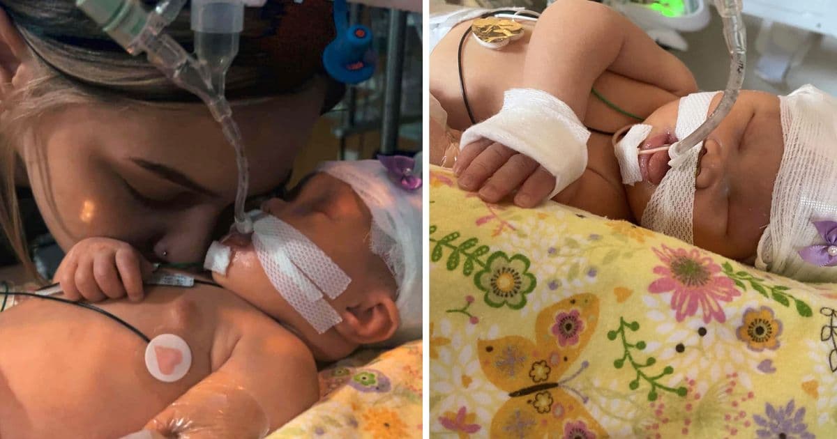 baby born without eyes harlym carter