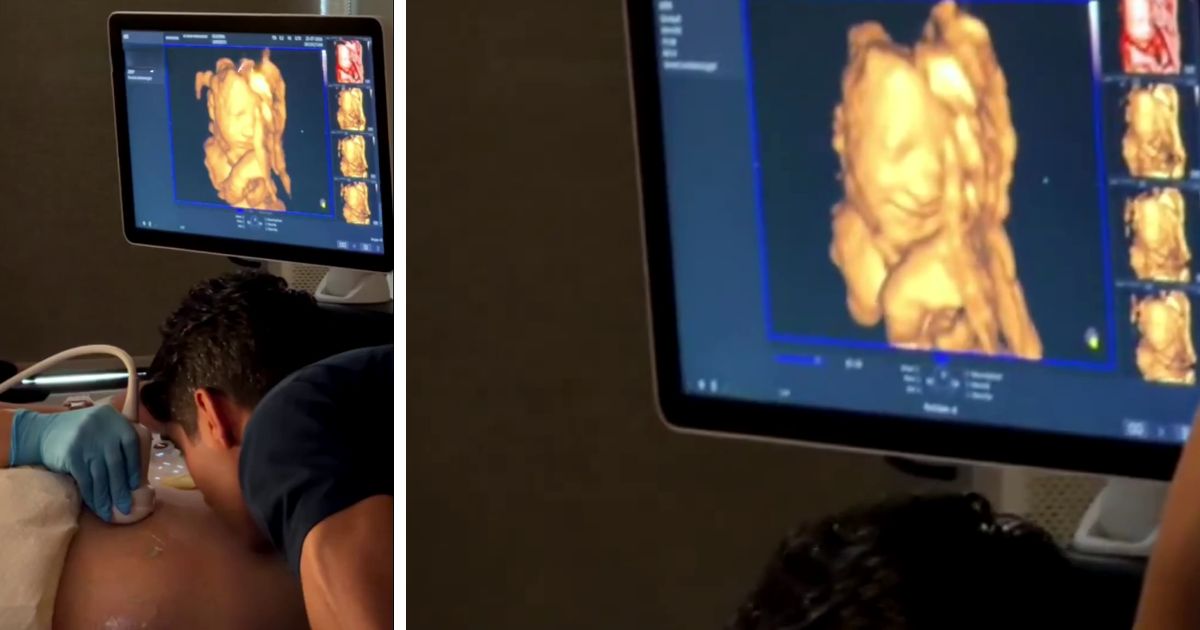 baby smiling during ultrasound