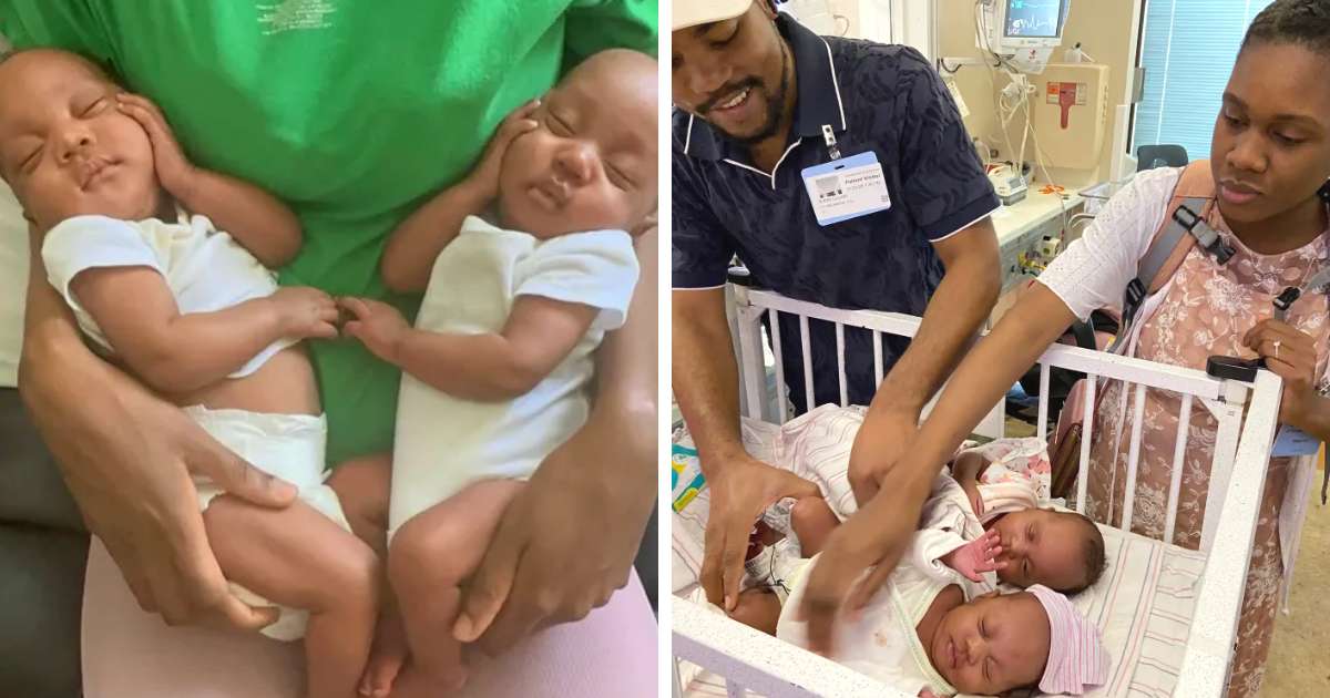 rare momo twins born holding each other